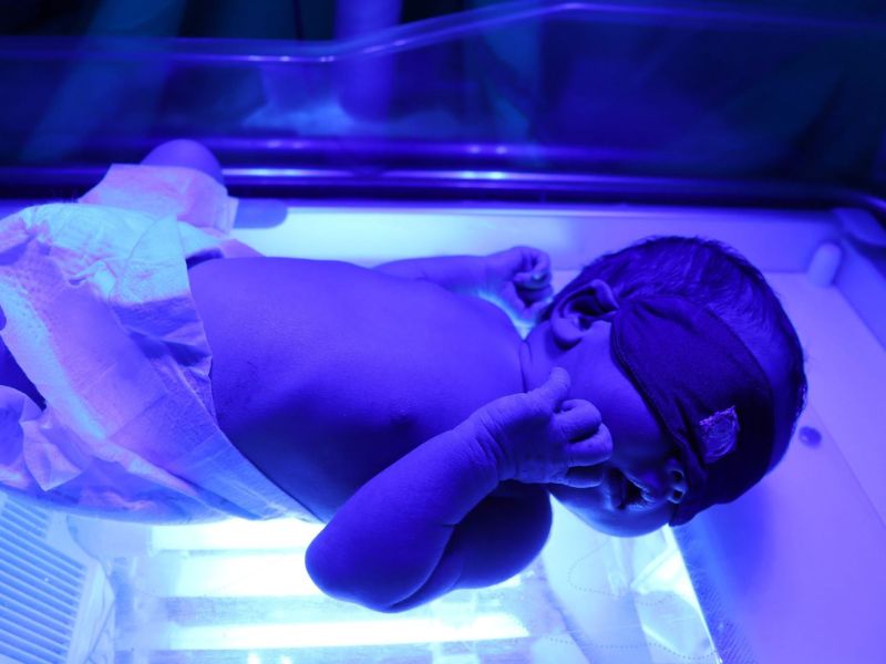 Tiếp nhận và đưa vào sử dụng Đèn chiếu vàng da cho trẻ sơ sinh